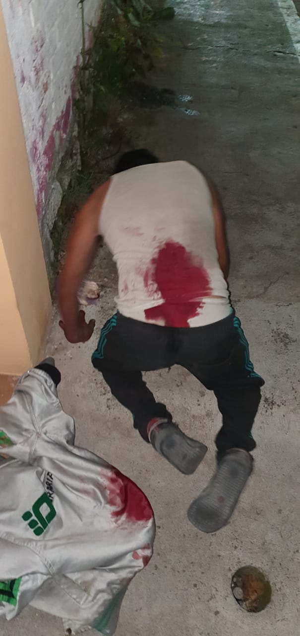 Fue lesionado por su propio hermano con un arma blanca