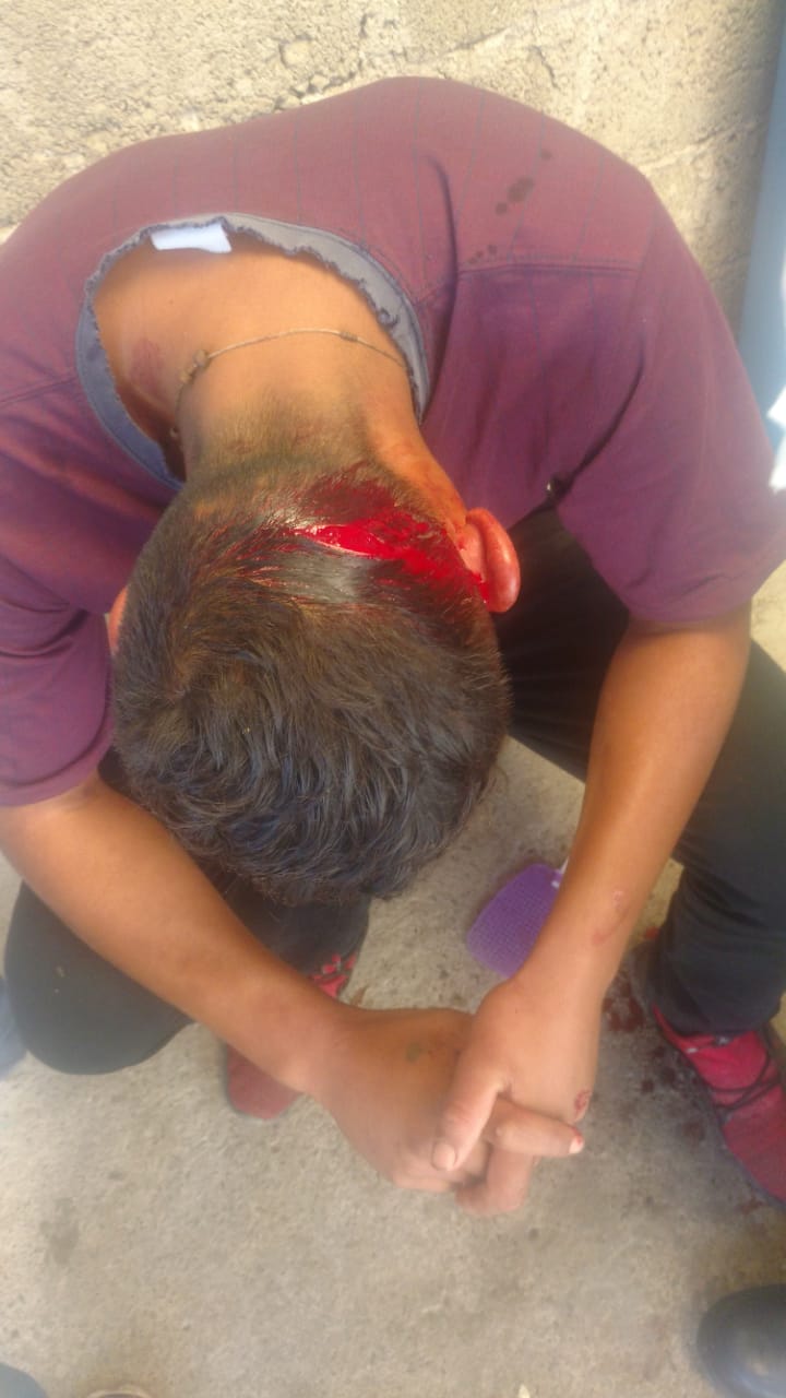 De un machetazo lesionan a un joven en Pueblo Nuevo