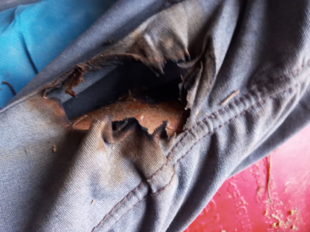 Resultó lesionado al recibir una descarga eléctrica