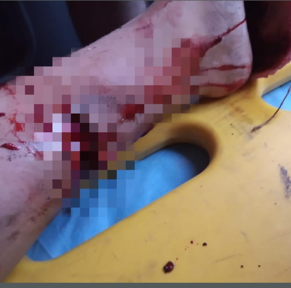 Piloto y copiloto resultaron lesionados al caer de la motocicleta en las curvas del gato