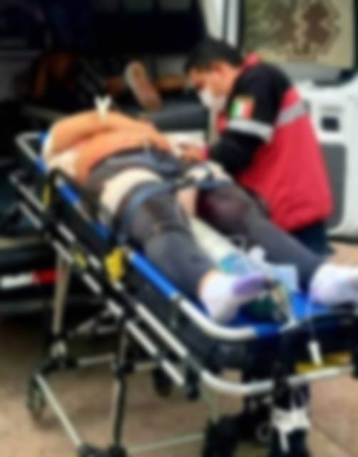 Hombres armados atacaron a balazos a una pareja que viajan en una motocicleta