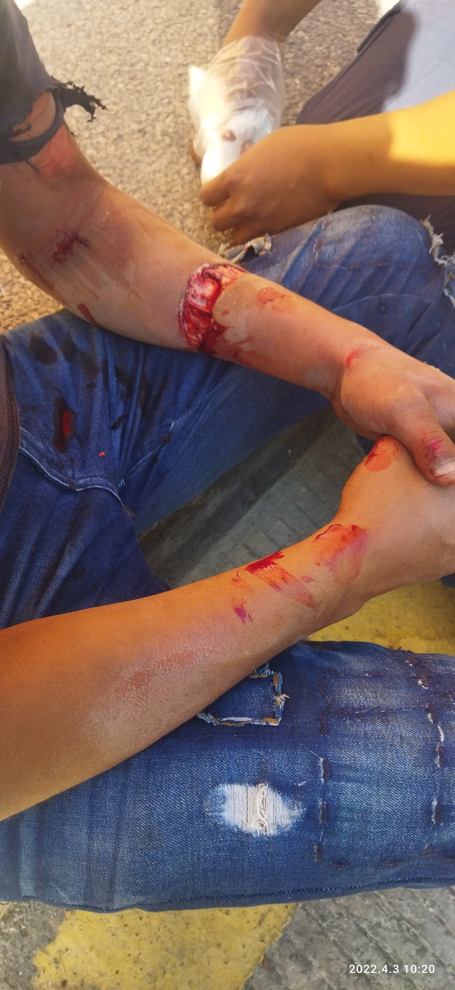 Dos jóvenes resultaron lesionados al caer de una motocicleta en el Libramiento Samuel Ramos de Zitácuaro