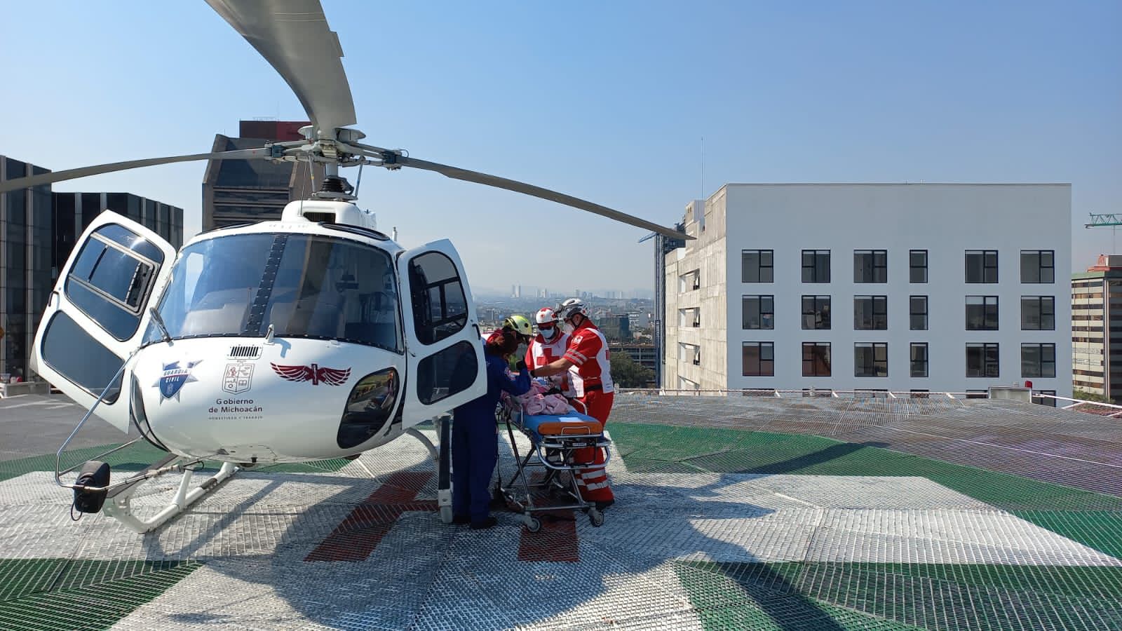 SSP traslada vía aérea a menor de edad con quemaduras a CDMX
