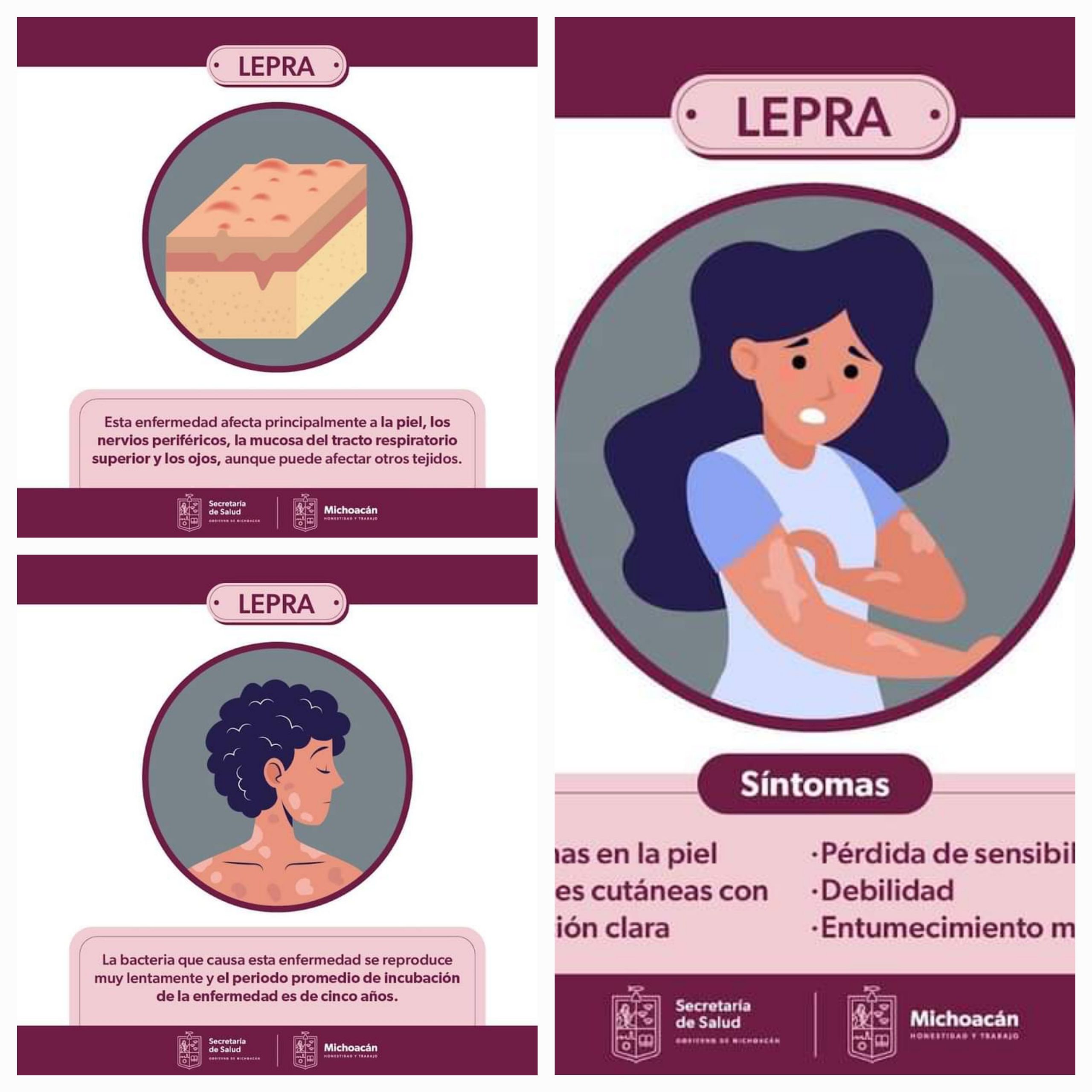 Michoacán garantiza la atención gratuita a pacientes con lepra.
