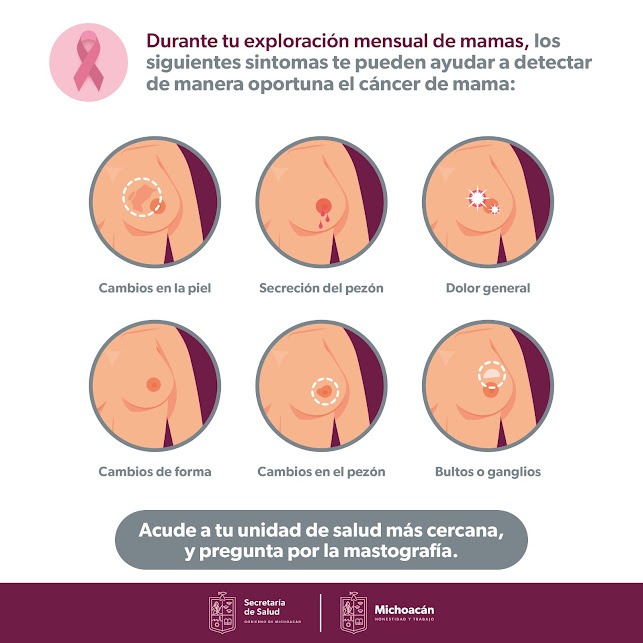 Disminuye en Michoacán mortalidad por cáncer de mama: SSM
