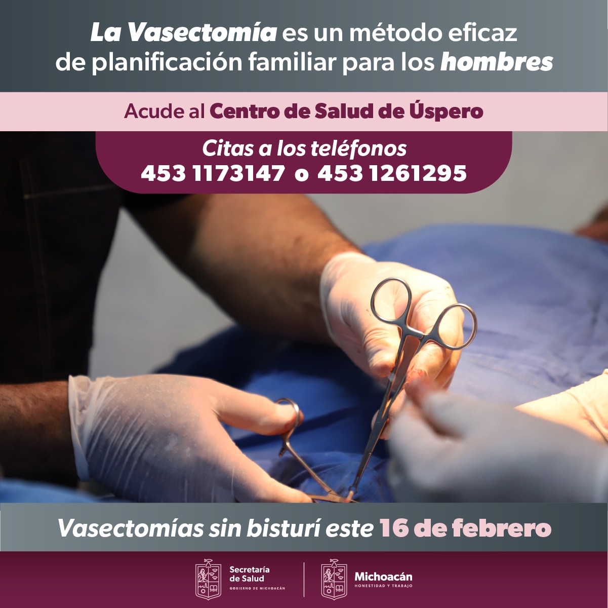 Anuncia SSM jornada de vasectomías sin bisturí en Úspero