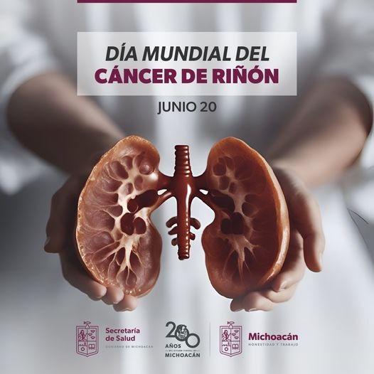 Conoce los síntomas del cáncer de riñón para detectarlo a tiempo: SSM