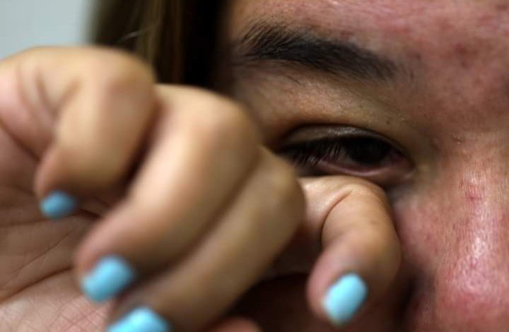 Extremar medidas sanitarias en temporada de lluvias, previene la conjuntivitis: SSM.