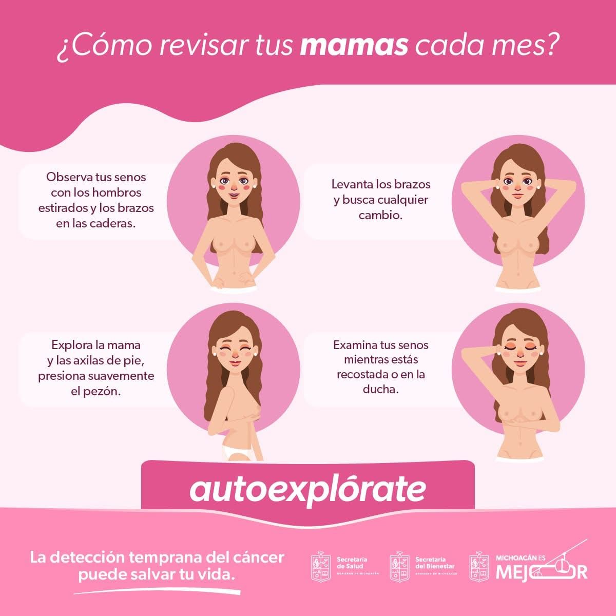 Reconoce los síntomas del cáncer de mama para actuar de inmediato