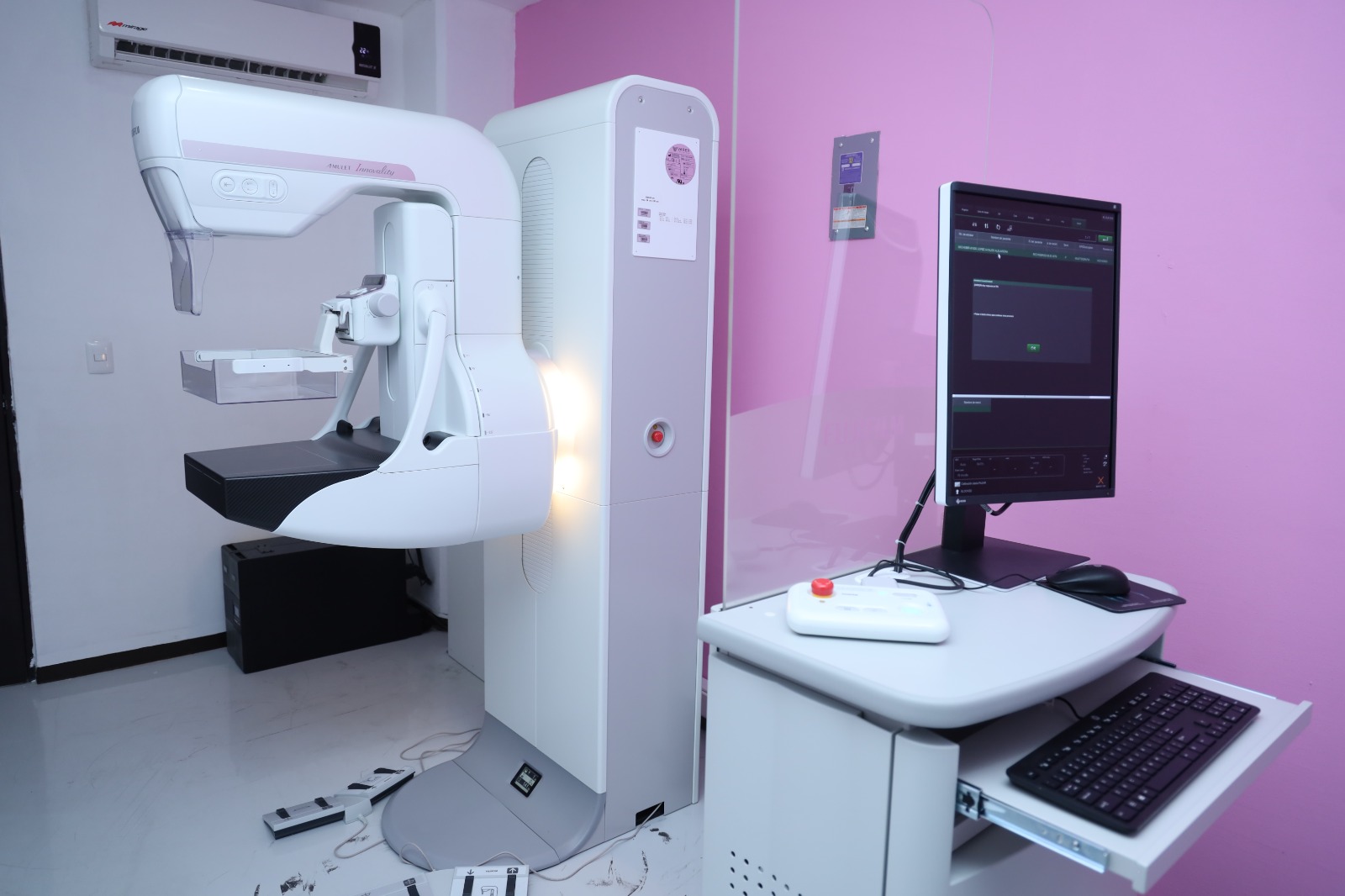 Mastografía, acción básica para detección oportuna de cáncer de mama: SSM.