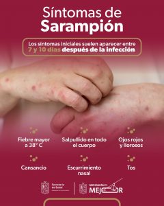 ¡No bajes la guardia! Ese sarpullido podría ser sarampión, aprende a identificarlo: SSM