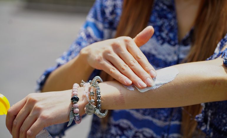 SSM llama a prevenir el sarpullido por altas temperaturas