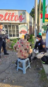 Motociclista resulta lesionado tras sufrir accidente en la carretera Toluca-Zitácuaro.